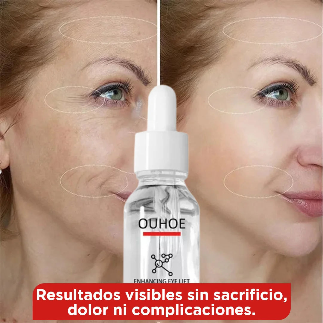 Rejuvenecedor en Gotas: ¡Piel Joven en Minutos – Sin Agujas y con Resultados Reales!