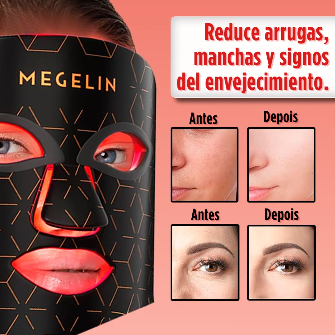 Máscara LED DermaLuz Pro con Luz Infrarroja – Silicona Flexible