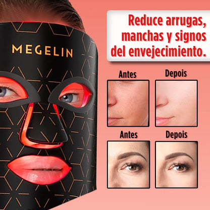 Máscara LED DermaLuz Pro con Luz Infrarroja – Silicona Flexible