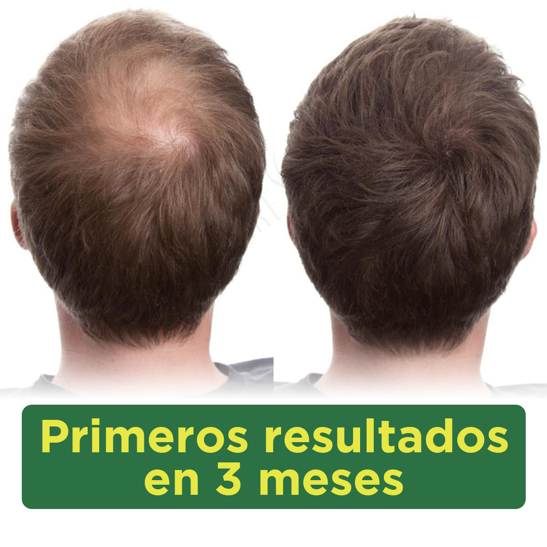 Tónico de jengibre activo - RegeneraFios 50ml