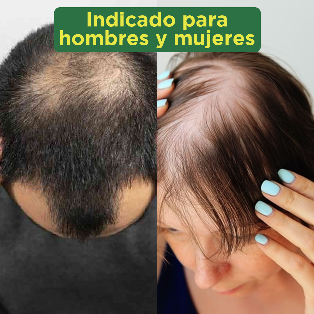 Tónico de jengibre activo - RegeneraFios 50ml